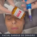 Tratamento Facial Sangue de Dragão curso online Tratamento Facial Sangue de Dragão curso online