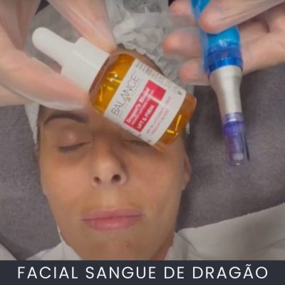 Tratamento Facial Sangue de Dragão curso online