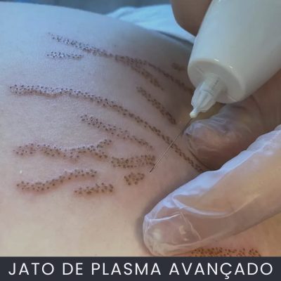 Jato de Plasma Avançado curso online