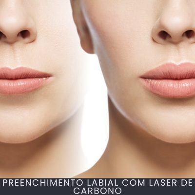 Preenchimento Labial com Laser de Carbono curso online