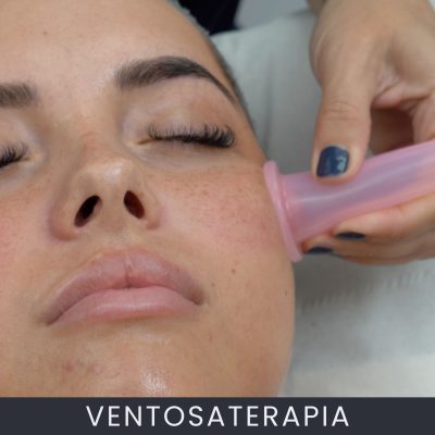 Ventosaterapia curso online