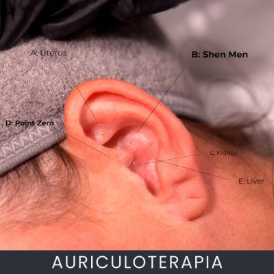 Auriculoterapia curso online