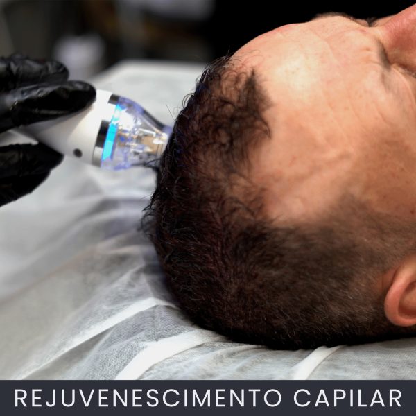 Rejuvenescimento Capilar curso online