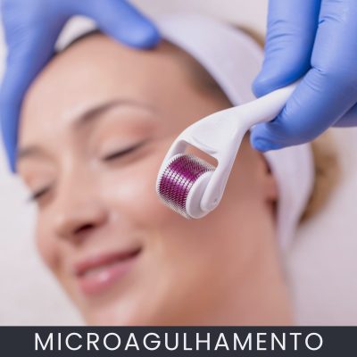 Microagulhamento curso online