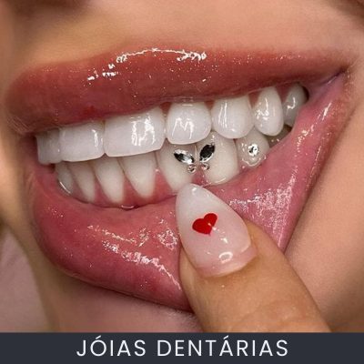 Jóias Dentais curso online