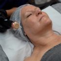 Curso De Oxibrasão Facial Online Curso De Oxibrasão Facial Online